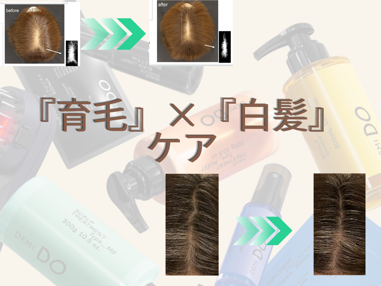 育毛×白髪エイジングケア
